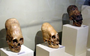 The photo of elongated skulls included in both articles. (Credit: Marcin Tlustochowicz/Wikimedia Commons)